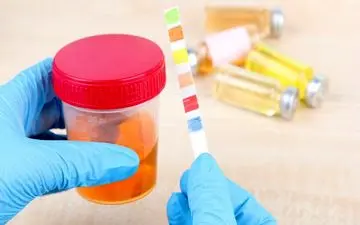 کشف ارتباط بین پروتئین آلبومین ادرار و ابتلا به زوال عقل