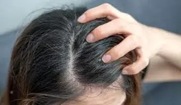 اگر از خارش پوست سر رنج میبرید حتما این مقاله را بخوانید!