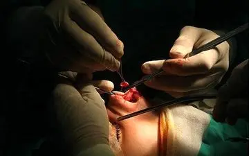  راز آزار و اذیت زن جوان تهرانی زیر عمل جراحی برملا شد/ ماجرا چیست؟