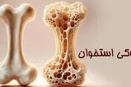 پوکی استخوان؛ تشخیص و درمان به‌ موقع