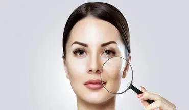 با این کارها پوستت را خراب نکن! ۵ دلیل بزرگ شدن منافذ صورت