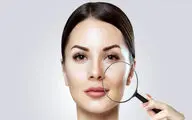 با این کارها پوستت را خراب نکن! ۵ دلیل بزرگ شدن منافذ صورت