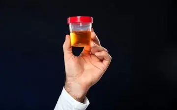 چند علت برای دفع دردناک ادرار 