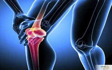 هشدار ! دشمن استخوان هایتان را بشناسید