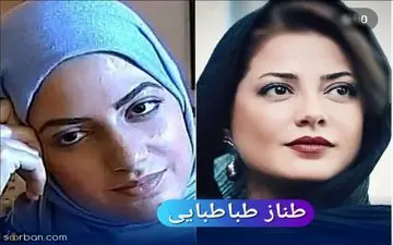 عروسک شدن این ۷ خانم بازیگر با عمل های زیبایی + اسامی و عکس های قبل و بعد !
