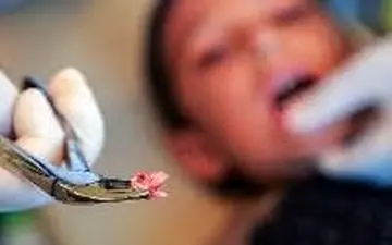 دستگیری ۹ دندانپزشک تهرانی با یک راز پلید