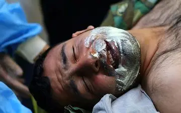  ۵۹ ایرانی سوختند 