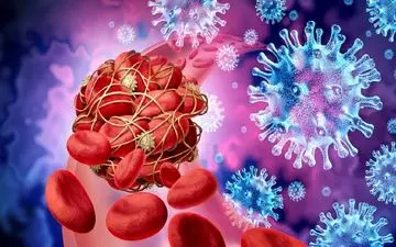 علائم خطرناکی که از لخته شدن خون در کرونایی‌ها خبر می‌دهند