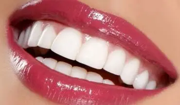 روش‌های سریع و موثر برای بهبود زیبایی دندان‌ها: نکاتی که باید بدانید
