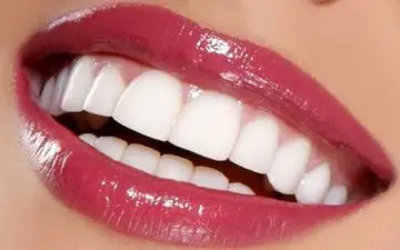 روش‌های سریع و موثر برای بهبود زیبایی دندان‌ها: نکاتی که باید بدانید
