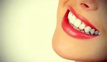  با این مواد ساده دندان های خود را در خانه سفید کنید!