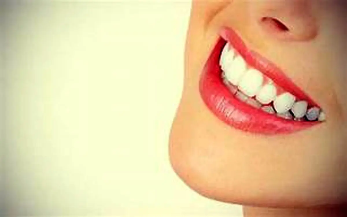  با این مواد ساده دندان های خود را در خانه سفید کنید!