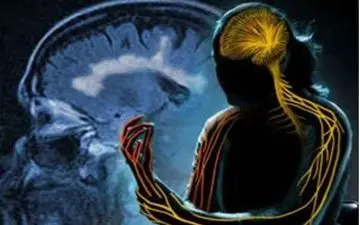 عامل اصلی بیماری ام اس شناسایی شد! 