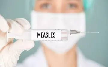 این افراد به مراقبت بیشتر در برابر سرخک نیاز دارند!