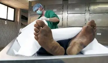 مرگ معمایی مرد تهرانی زیر تیغ جراحی روده