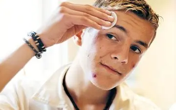 علت چرب شدن پوست