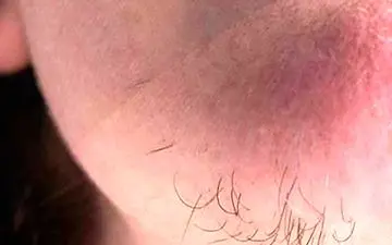 با این راهکار ساده از شر موهای زائد خلاص شوید!