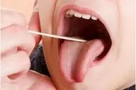 اگر زبان تان زردرنگ است این مطلب را بخوانید

