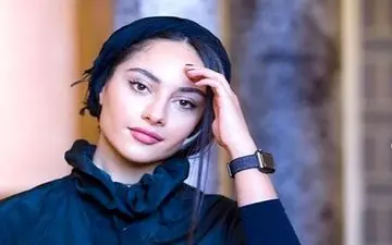 تفاوت وحشتناک چهره ترلانه پروانه بعد از عمل جراحی صورت! + عکس