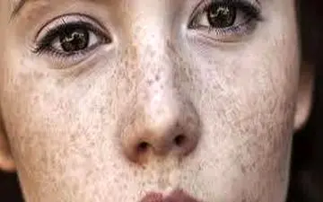 تتوی «کک مک» روی صورت دختران ایرانی ! 