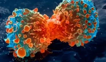 دستیابی به روش های درمانی امیدبخش برای درمان سرطان/راهکارهای ساده اما موثر در پیشگیری از سرطان