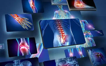  علل ایجاد التهاب در بدن