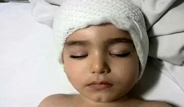 کودکی که در حادثه سقوط از «سُرسُره» ضربه مغزی شد + عکس