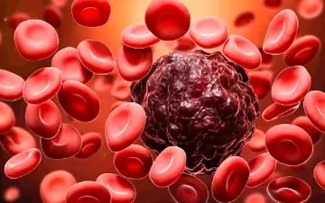 ارتباط جدید غافلگیرکننده‌ میان سلامت روده و خطر ابتلا به لوسمی