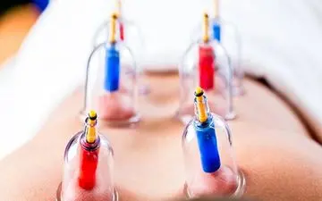 حجامت را می شود جایگزین درمان کرد؟