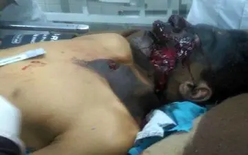 فوری / ​انفجار بمب در زابل + عکس