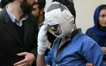 چهارشنبه‌سوری خونین در همدان؛ سه قطع عضو و ۱۵۹ مصدوم!
