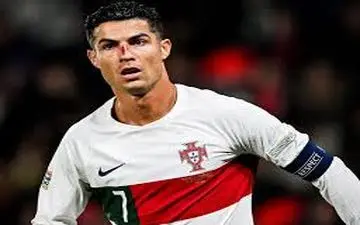 دلخراش‌ترین تصویر از رونالدو/ صورت کریستیانو غرق در خون