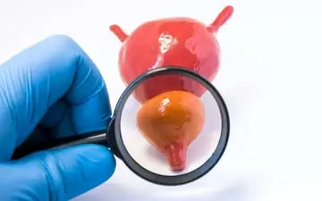 عوارض پروستات بزرگ