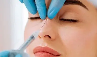 هشدار نسبت به مصرف ژل‌های تزریقی زیبایی