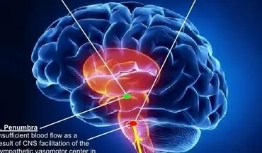 درمان پارکینسون با برنامه‌ریزی مجدد سلول‌های مغز