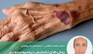 آیا کاهش پلاکت خون نشانه سرطان است؟ | روش های تشخیص ترومبوسیتوپنی

