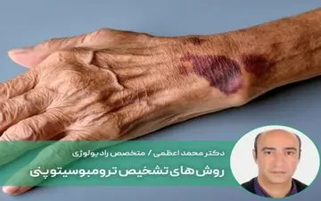 آیا کاهش پلاکت خون نشانه سرطان است؟ | روش های تشخیص ترومبوسیتوپنی

