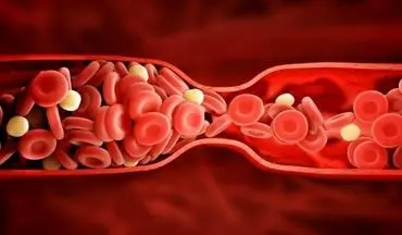 هشدار جدی به زنان چاق/ قرص های ضدبارداری باعث افزایش لختگی خون می شود