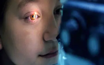 روماتیسم چشمی چیست؟