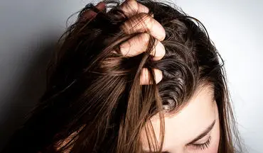 دلایل زود به زود چرب شدن موها | راهکارهایی برای رهایی از چربی مو