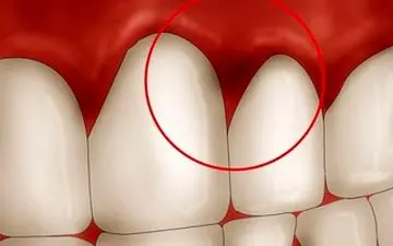  بیش از حد مسواک نزنید