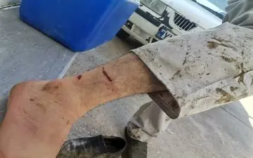 حمله سگ گله، کارمند دامپزشکی را در چرام راهی بیمارستان کرد!
