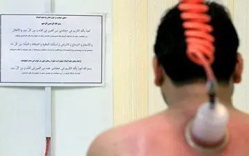 حجامت، زالودرمانی و انواع ماساژها تعرفه‌دار شدند