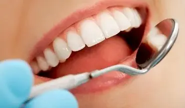 چند راهکار ساده برای به حداقل رساندن پوسیدگی‌های دندانی