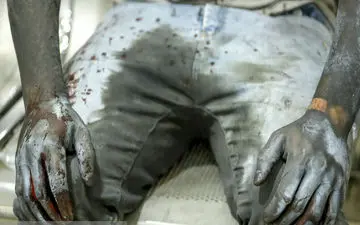 عبور تعداد مصدومان حوادث مرتبط با چهارشنبه سوری از 2000 نفر/ بیشترین تعداد مصدوم در تهران