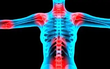 این ویتامین سبب کاهش التهاب بدن می‌شود

