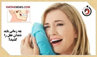 چه زمانی باید دندان عقل را کشید؟
