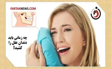 چه زمانی باید دندان عقل را کشید؟