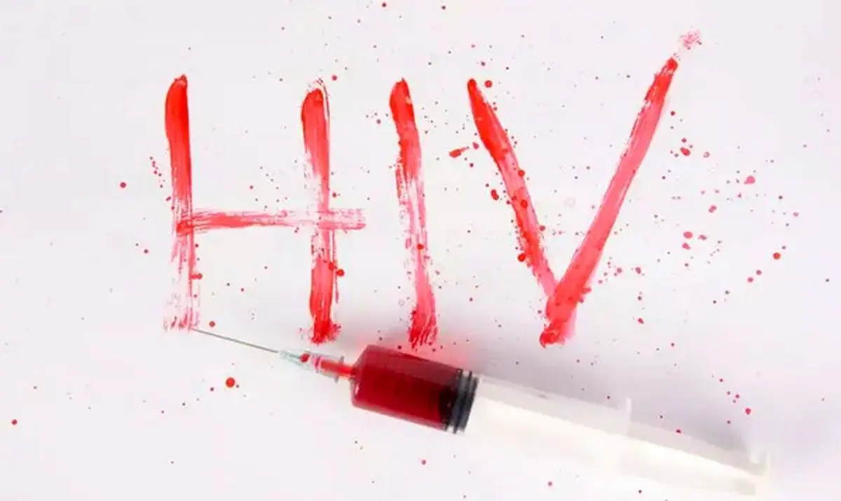 وضعیت HIV در ایران چگونه است؟