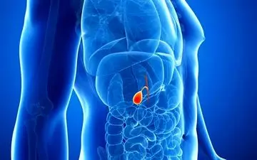 بهترین درمان سنگ صفرا چیست؟